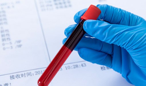 BIOCHEMICAL (BLOOD, ETC.)TESTING